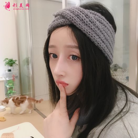 做完膨体隆鼻和自体软骨隆鼻后,鼻子挺了很多 做完膨体隆鼻和自体软骨隆鼻后,鼻子挺了很多