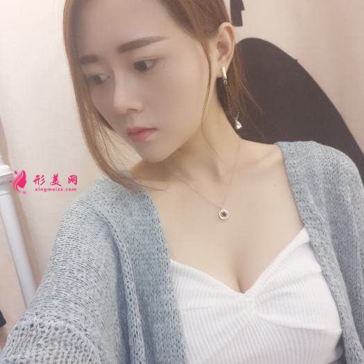 做自体肋软骨和膨体综合隆鼻后感受 做自体肋软骨和膨体综合隆鼻后感受