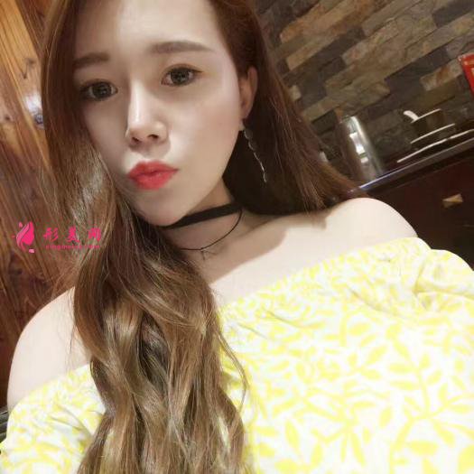 做自体肋软骨和膨体综合隆鼻后感受 做自体肋软骨和膨体综合隆鼻后感受