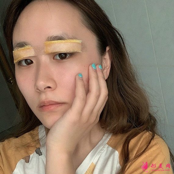 全切双眼皮恢复的速度很快,就算是素颜也很美! 全切双眼皮恢复的速度很快,就算是素颜也很美!