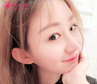 北京美莱医疗美容医院鼻部多项手术案例