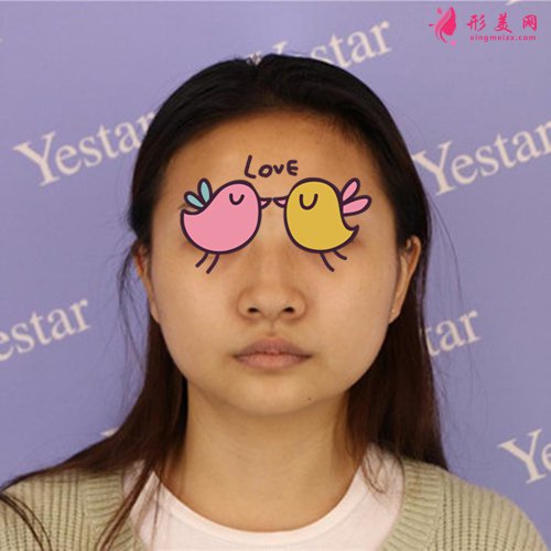 温州艺星做鼻子怎么样 温州艺星做鼻子怎么样