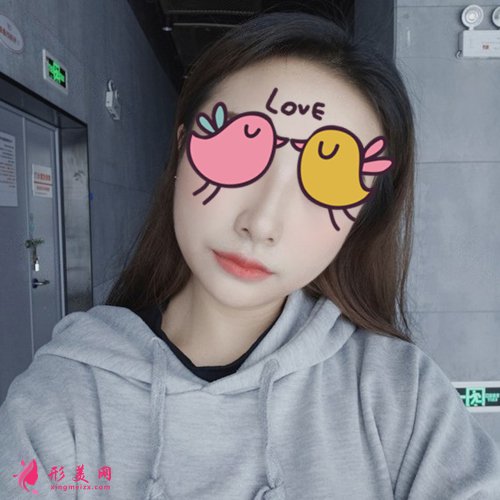 温州哪家医院隆鼻好 温州哪家医院隆鼻好