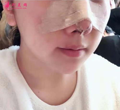 宁波哪个医生做鼻子厉害 宁波哪个医生做鼻子厉害