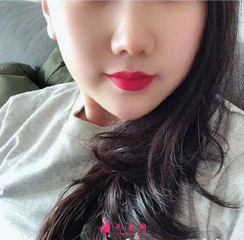 宁波壹加壹整形做鼻子好吗 宁波壹加壹整形做鼻子好吗