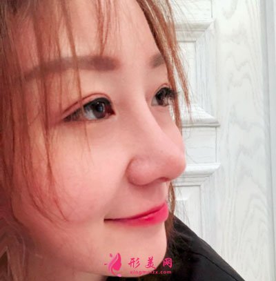 北京美莱医疗美容医院鼻部多项手术案例