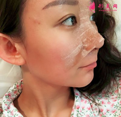 北京美莱医疗美容医院鼻部多项手术案例