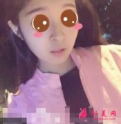 山东省立医院整形科隆鼻怎么样？术后案例前后对比图