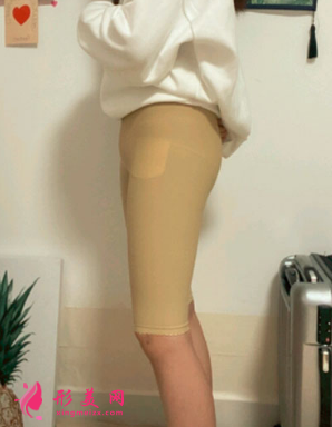 宁波静港整形美容祝海新案例 宁波静港整形美容祝海新案例