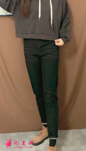 宁波静港整形美容祝海新案例 宁波静港整形美容祝海新案例