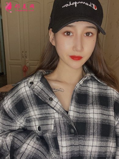 李院长面部填充术后图