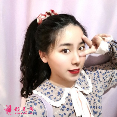 天姿医疗美容医院李烈面吸案例