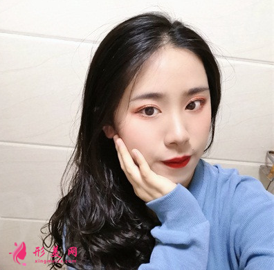 天姿医疗美容医院李烈面吸案例