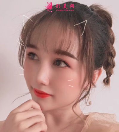 武汉韩辰医疗美容医院吴辉鼻部整形案例对比图 武汉韩辰医疗美容鼻部多项案例