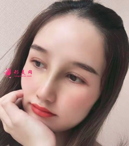 武汉韩辰医疗美容医院吴辉鼻部整形案例对比图 武汉韩辰医疗美容鼻部多项案例