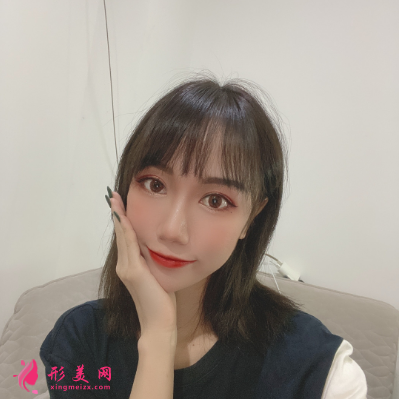 深圳福华整形医院李敏双眼皮