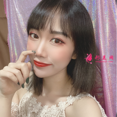 深圳福华整形医院李敏双眼皮