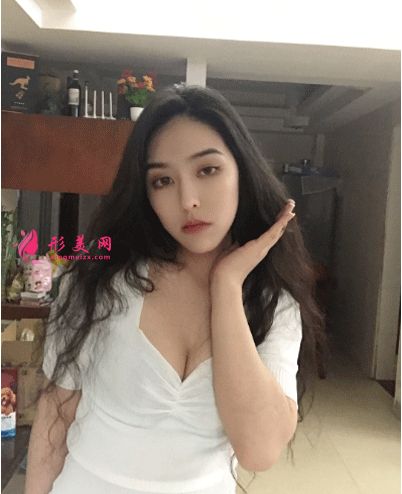 北京叶子整形医院鲁礼新隆胸 隆胸三个月后