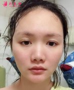 河北省三院整形科价格表收费趋势&amp;隆鼻案例效果图反馈给大家