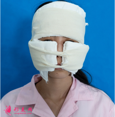 武汉美亚金国华面部脂肪填充 武汉美亚金国华面部脂肪填充