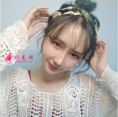 武汉美亚整形医院刘佳亮双眼皮 武汉美亚整形医院刘佳亮双眼皮