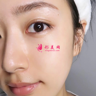 武汉美亚整形医院谢大明面部除皱 武汉美亚整形医院谢大明面部除皱