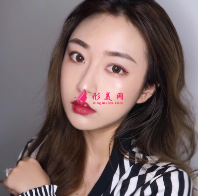 武汉美亚整形医院谢大明面部除皱 武汉美亚整形医院谢大明面部除皱