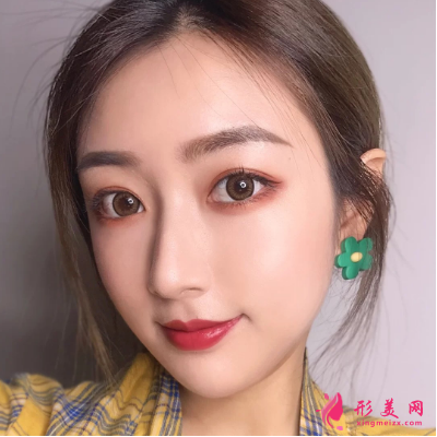 武汉美亚整形医院谢大明面部除皱 武汉美亚整形医院谢大明面部除皱