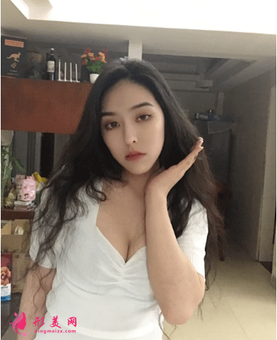 北京叶子整形医院鲁礼新隆胸 隆胸三个月后