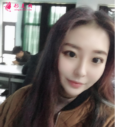 深圳江南春天李刚隆鼻技术