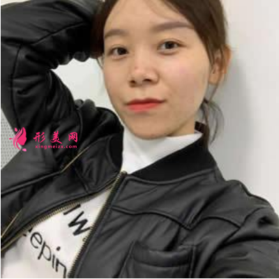 北京圣嘉新整形医院康华去痘坑