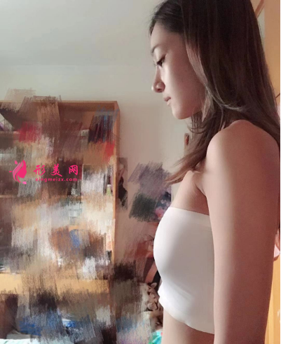 武汉艺星雷云飞假体隆胸 武汉艺星雷云飞假体隆胸