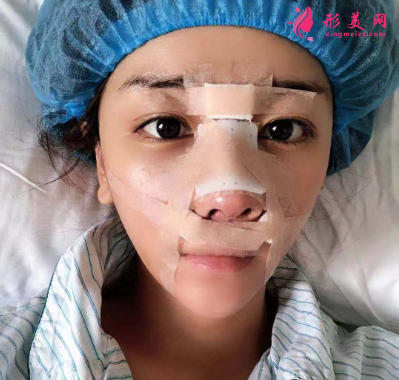 武汉德美余萌隆鼻术