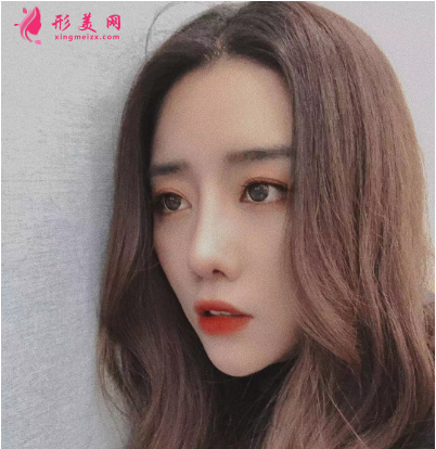 武汉德美余萌隆鼻术