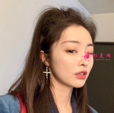 武汉华亚整形医院李爱林面部除皱 武汉华亚整形医院李爱林面部除皱