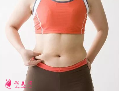 腹部吸脂后多久可以正常上班