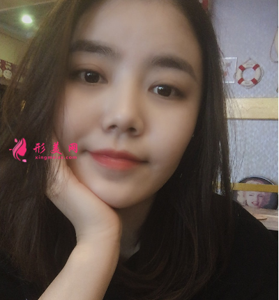 武汉韩辰整形医院樊辉华面部吸脂 武汉韩辰整形医院樊辉华面部吸脂