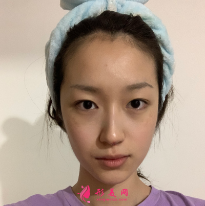 武汉韩辰整形医院牛永敢隆鼻技术 武汉韩辰整形医院牛永敢隆鼻技术