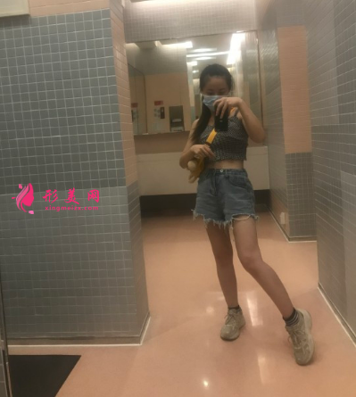 成都华人医联整形医院张红芳大腿吸脂