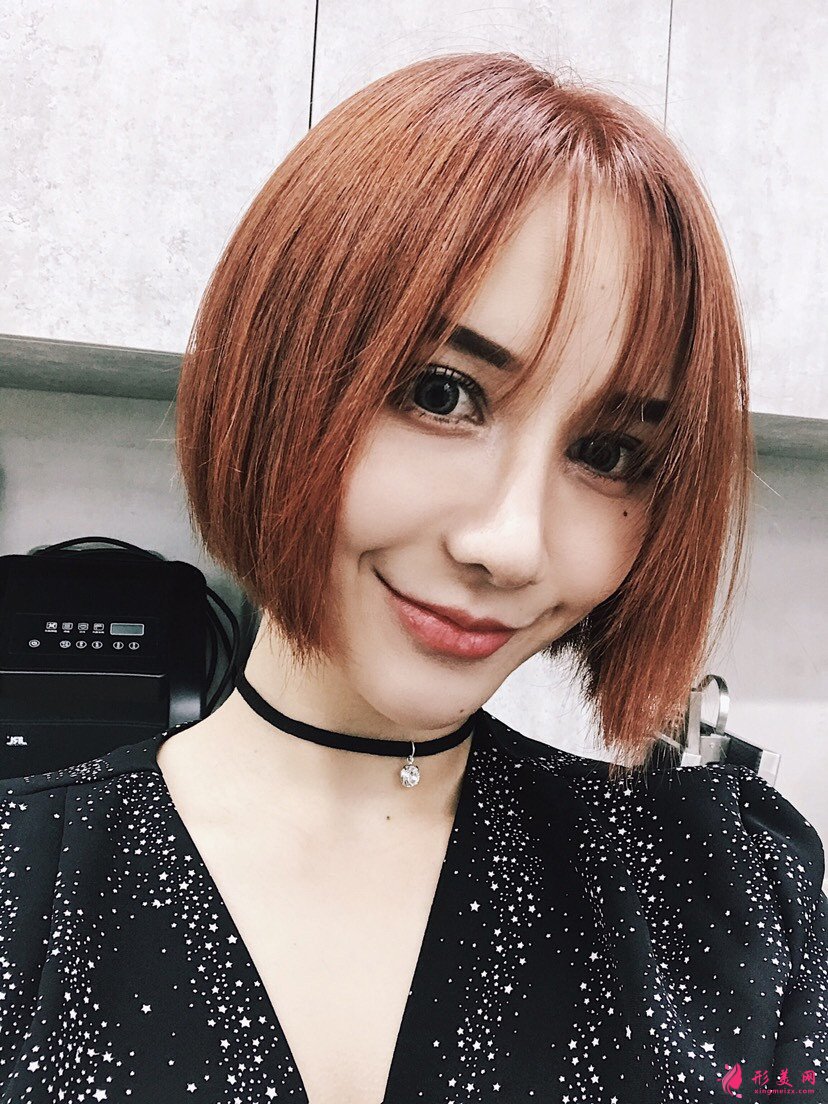 黑眼圈如何去除?填充玻尿酸泪沟+黑眼圈一步解决