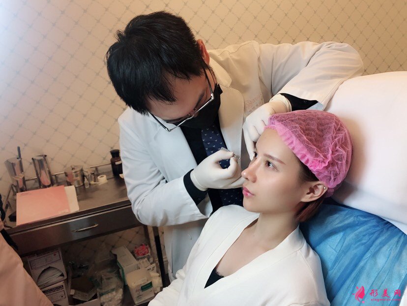 黑眼圈如何去除?填充玻尿酸泪沟+黑眼圈一步解决