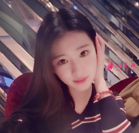 面部瘦脸我选择了打瘦脸针,效果好明显哦~