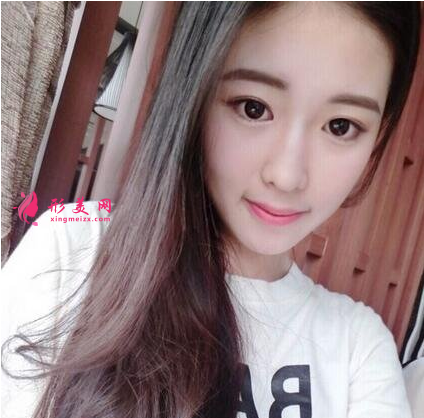 面部瘦脸我选择了打瘦脸针,效果好明显哦~