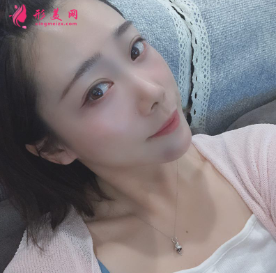 韩缘聚美做水氧活肤怎么样呢?案例30天术后效果真的好极了