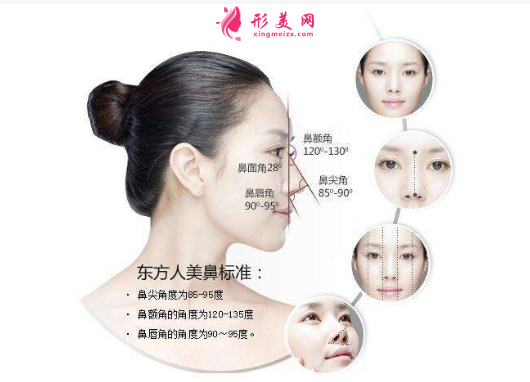 隆鼻失败修复手术为何那么贵?
