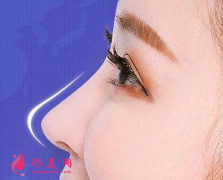 自体肋骨隆鼻保持多久？