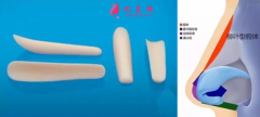 隆鼻哪里做得好？