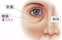 年轻人为什么会有眼袋？