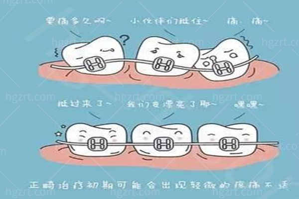 丽水矫正牙齿哪家医院好 丽水矫正牙齿哪家医院好
