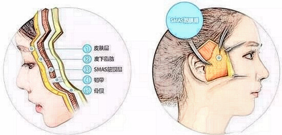 谁知道祝东升大夫5层提升费用情况?求问祝东升面部提升价格 谁知道祝东升大夫5层提升费用情况?求问祝东升面部提升价格